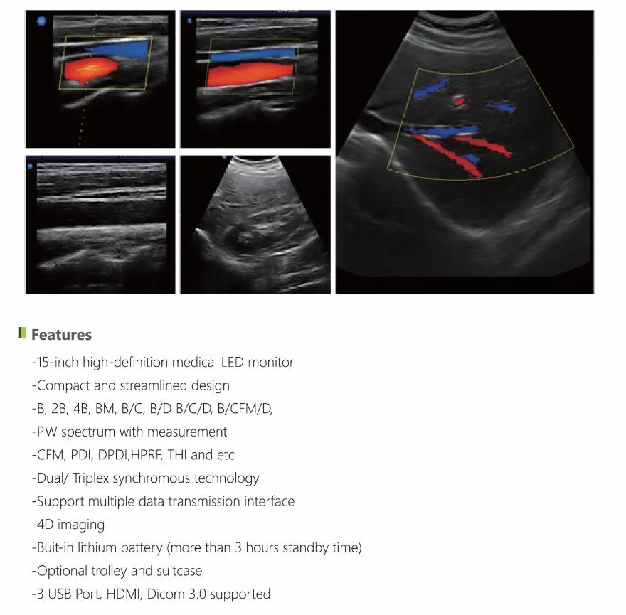 Hochey Medical Wireless Ultrasound Probe Large LED Screen 4D Mode Color Doppler Laptop Type Scanner for Body Examine