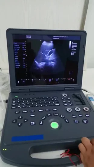 Sonda de ultrassom sem fio médica Hochey Grande tela LED Modo 4D Color Doppler Scanner tipo laptop para exame corporal